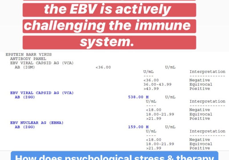 ebv blood test